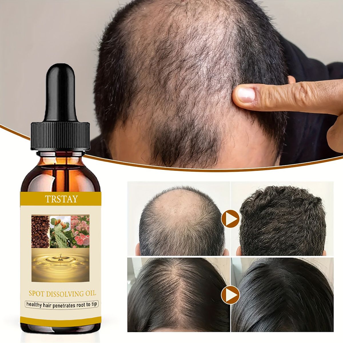 Beard Oil - 50ML huile de croissance de barbe